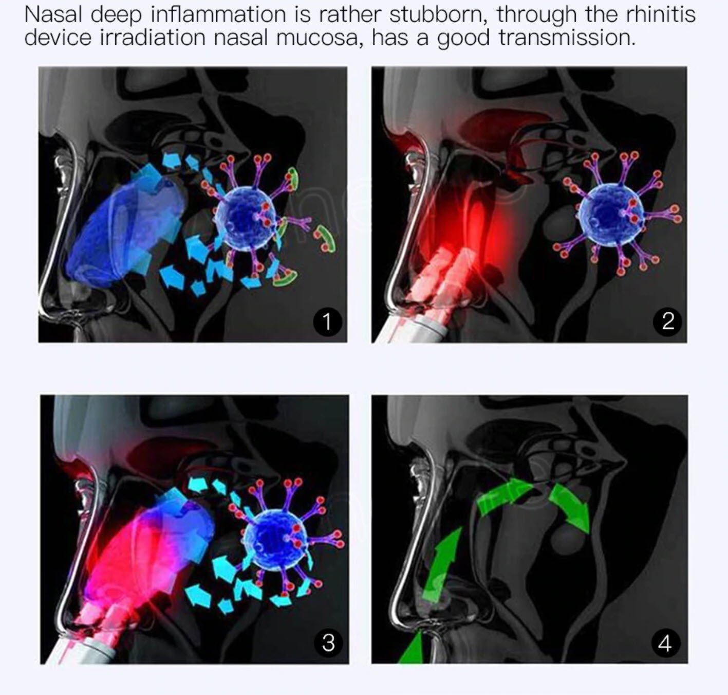 Nasal Relief Infrared Therapy Device