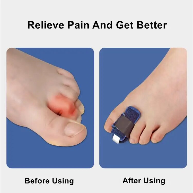 Soft Toe Spacer Corrector Support