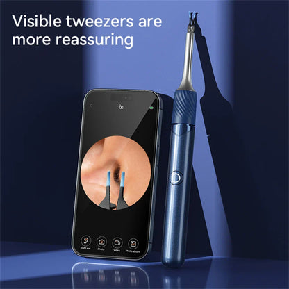 Wireless Ear Cleaning Camera with HD Vision