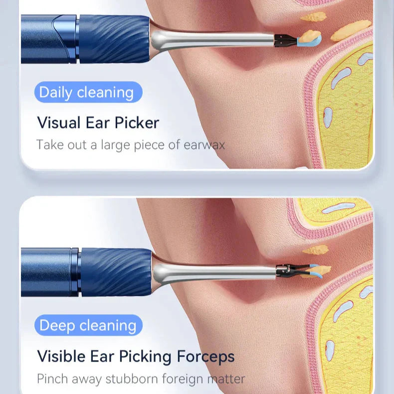 Wireless Ear Cleaning Camera with HD Vision