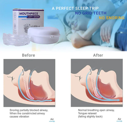 Anti Snore Sleep Solution Device