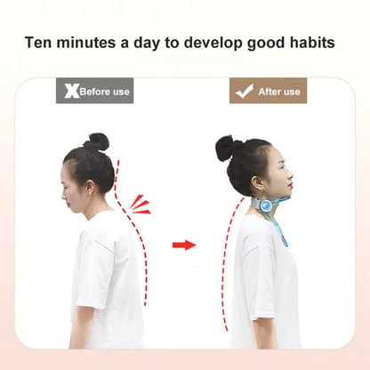 Contour Jaw Exerciser Fitness Device