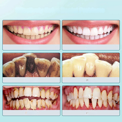 Advanced Sonic Toothbrush - Effective Plaque Remover