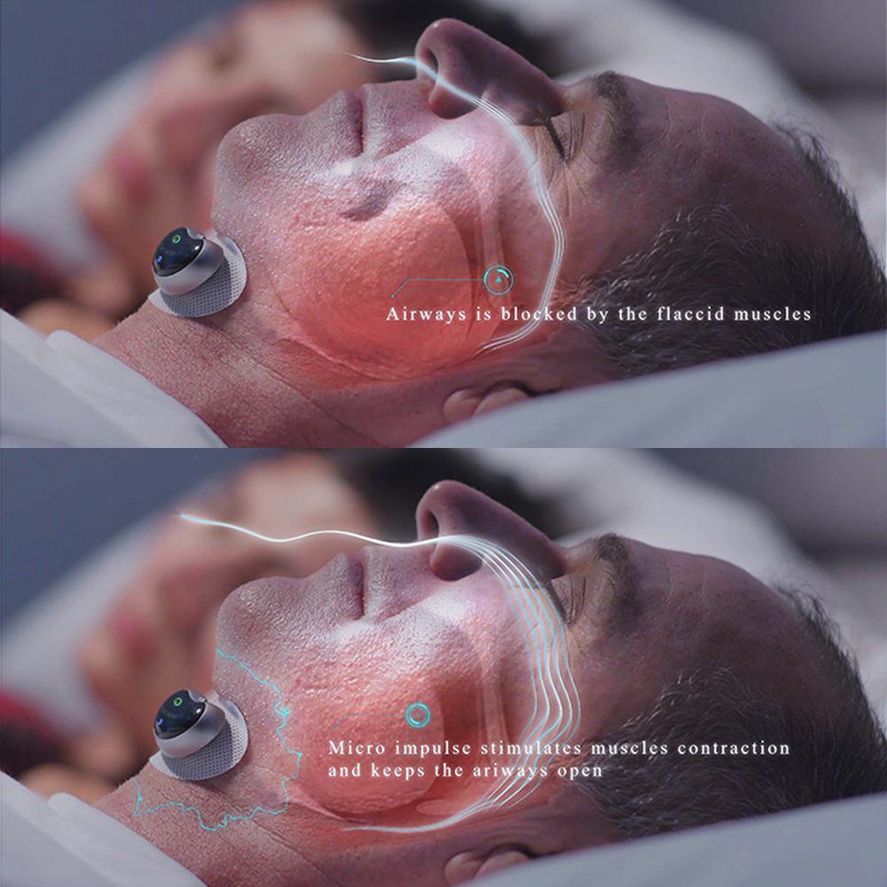 Advanced Anti Snore Sleep Solution Pro