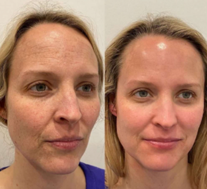 Advanced Collagen Face Mask: Deep Hydrating Anti Aging