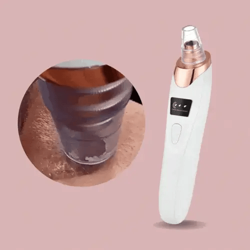 Easy Blackhead Cleaner Facial Vacuum Tool - Luxicro
