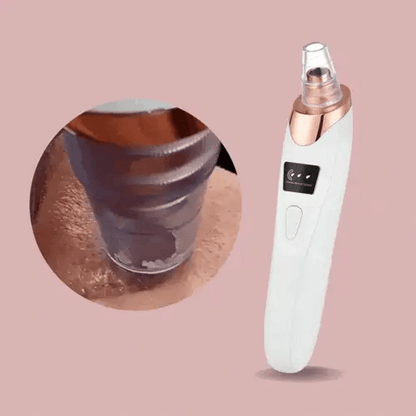 Easy Blackhead Cleaner Facial Vacuum Tool - Luxicro