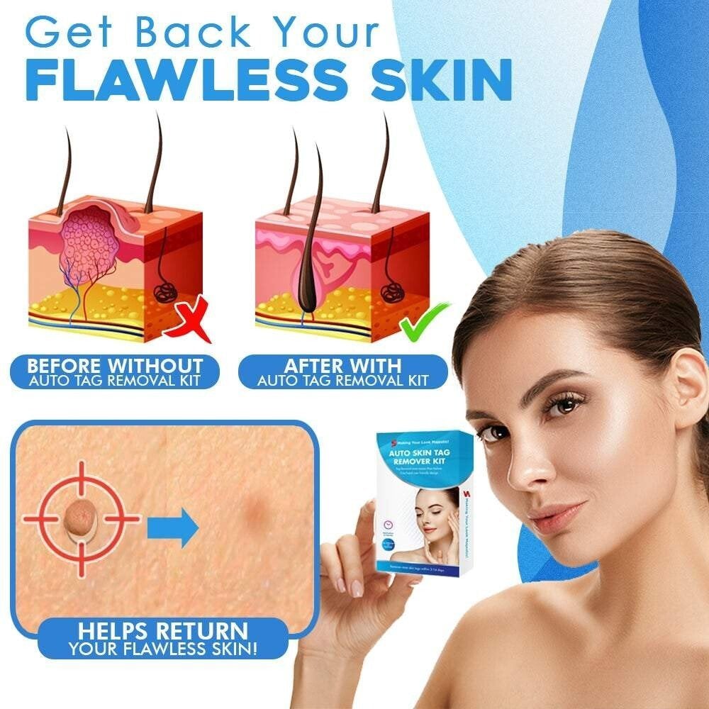 Easy Hair Removal at Home in 10 Days