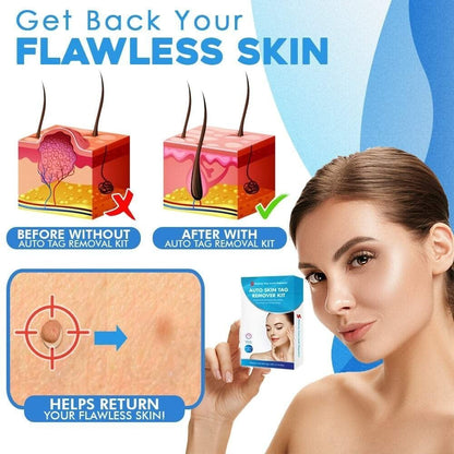Easy Hair Removal at Home in 10 Days
