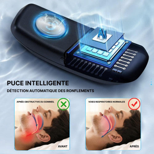 Proven Anti Snore Sleep Aid Device