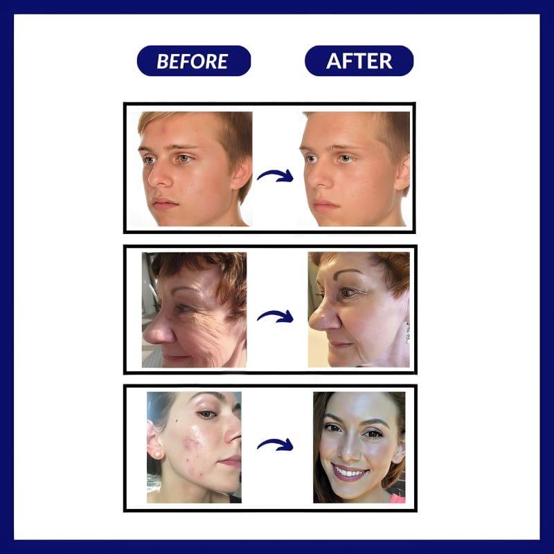 Brightening Anti Aging Facial Mask