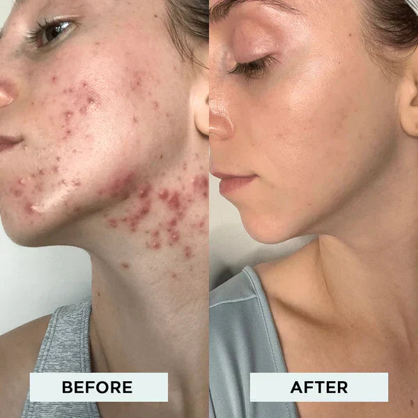 Advanced Anti Aging Face Massager