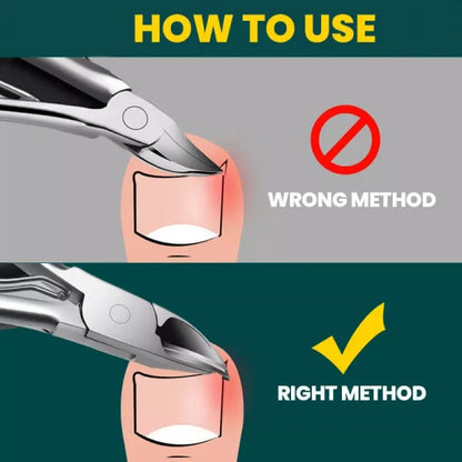 Easy Use Orthopedic Nail Clipper