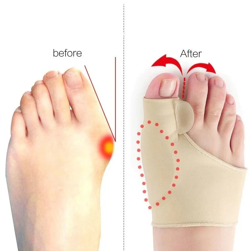 Soft Gel Toe Separators with Arch Relief