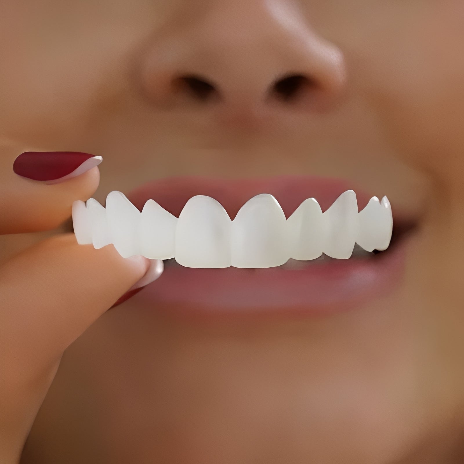 Real Teeth Veneers with Bright White Smile - Luxicro