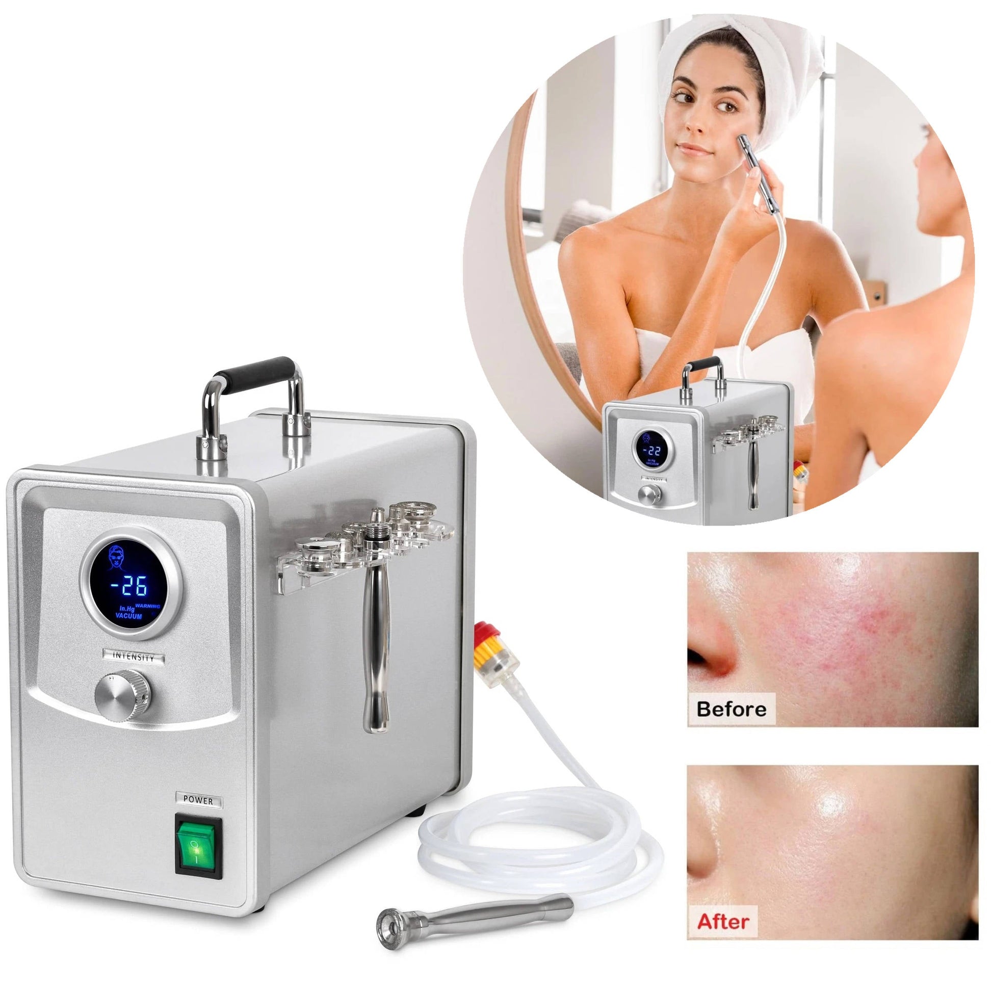 Advanced Home Microdermabrasion Skin Care Machine - Luxicro