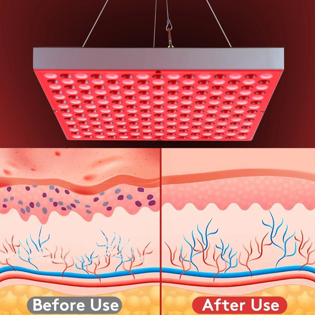Powerful LED Pain Relief Light Therapy Lamp
