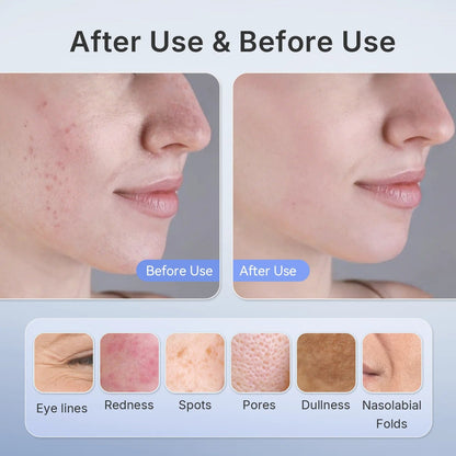 Lightweight Anti-Aging LED Face Mask