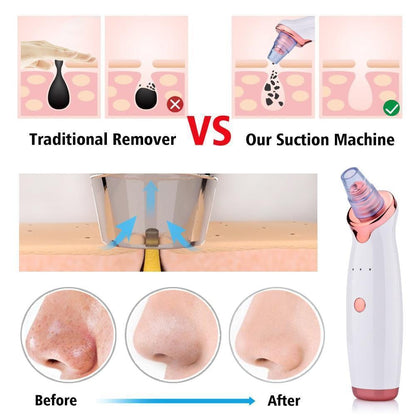 Effective Pore Vacuum Blackhead Remover
