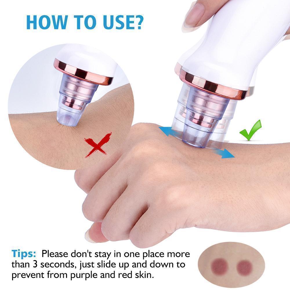 Effective Pore Vacuum Blackhead Remover