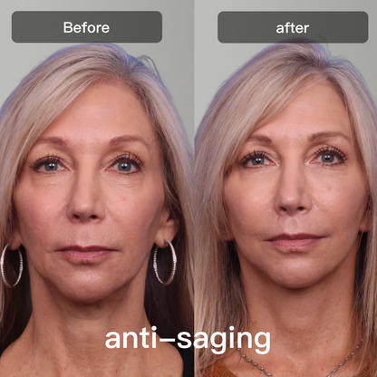 Advanced 7 Color Facial Skin Care Device