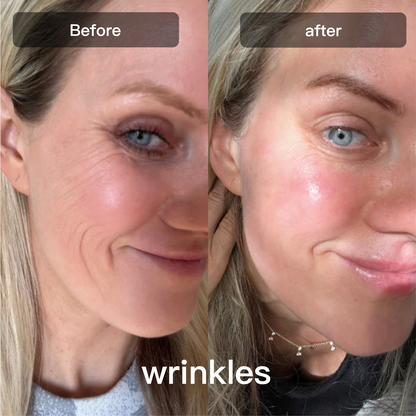 Advanced 7 Color Facial Skin Care Device