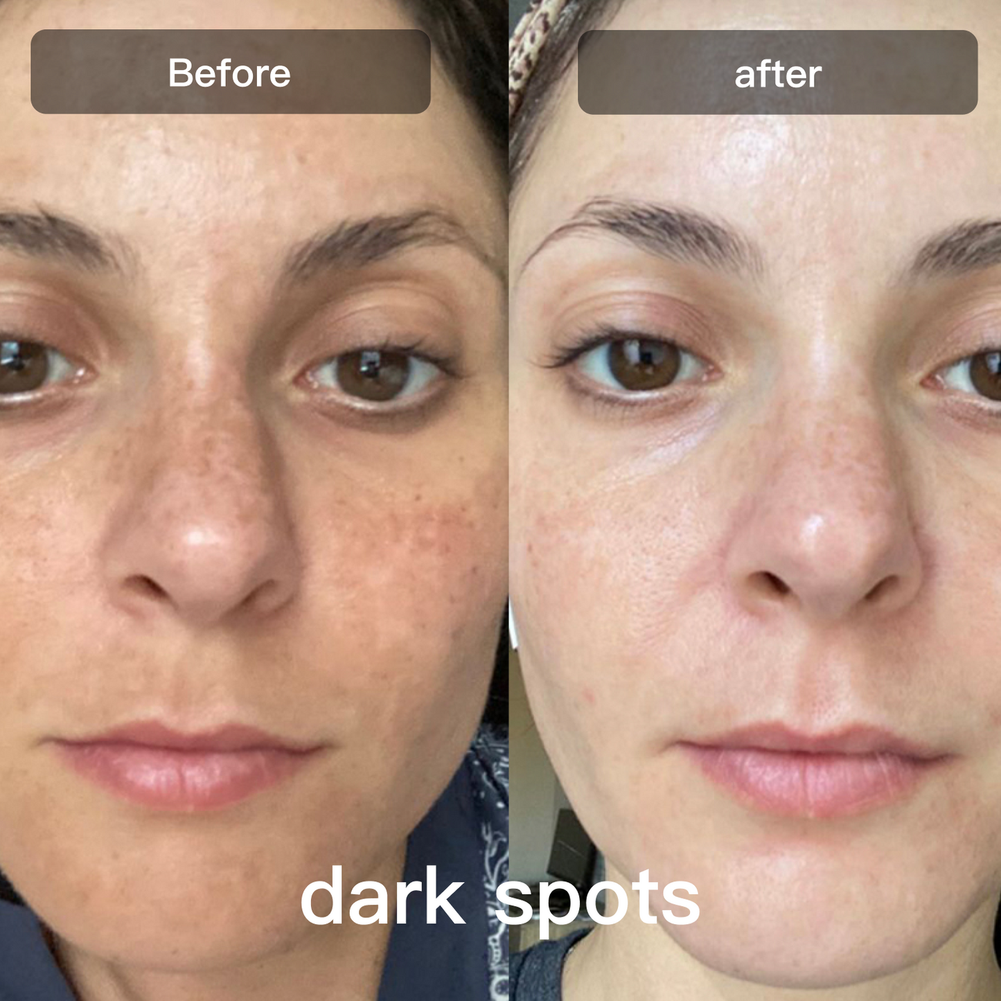 Advanced 7 Color Facial Skin Care Device