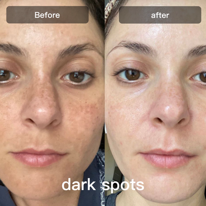 Advanced 7 Color Facial Skin Care Device