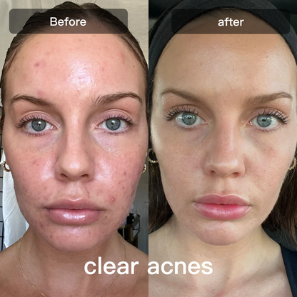 Advanced 7 Color Facial Skin Care Device
