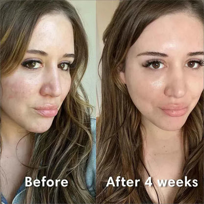 Moisturizing Overnight Face Mask