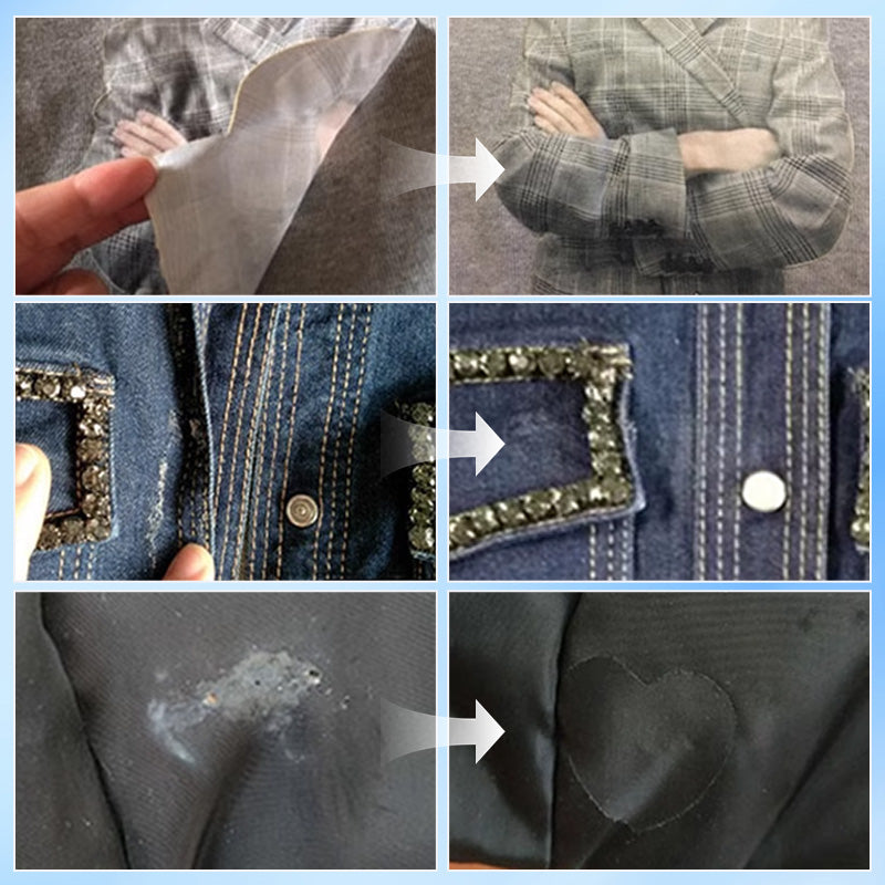 Quick Fix Clothing Patch Kit