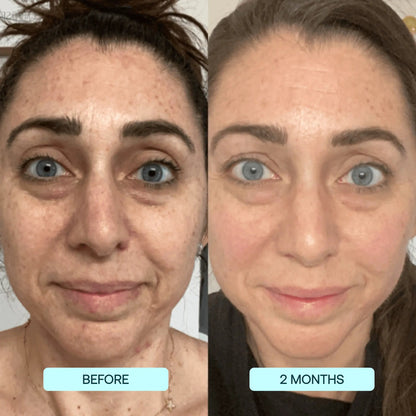 Advanced Collagen Face Mask: Deep Hydrating Anti Aging